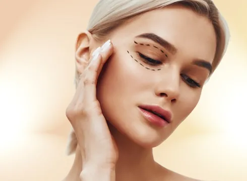 Blefaroplastia